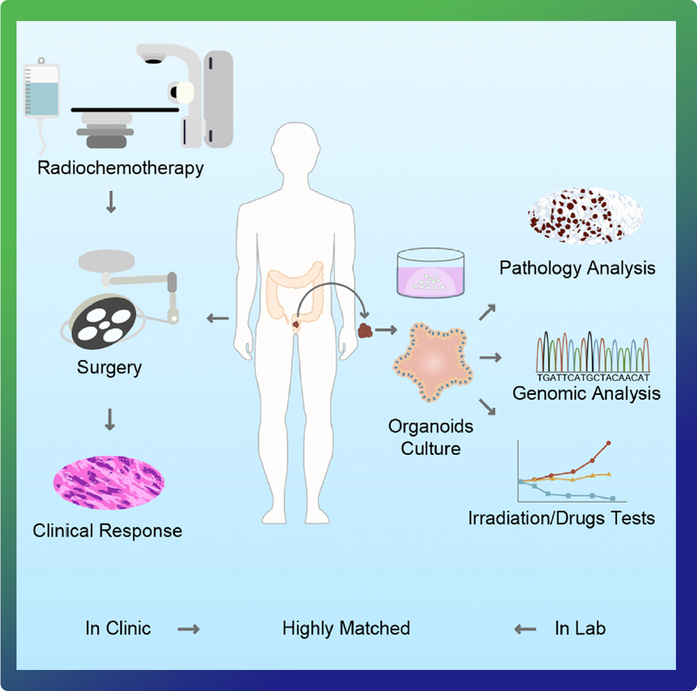 Cell Stem Cell | PDO可预测局部晚期直肠癌的放化疗反应